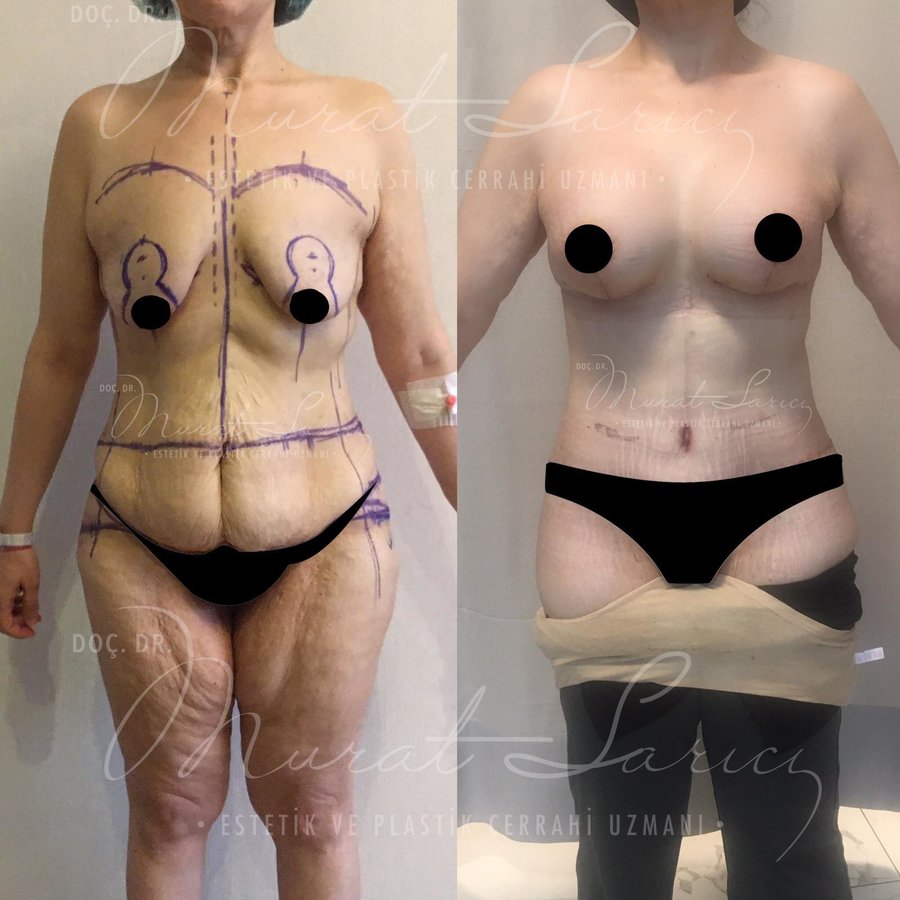 Assoc. Prof. Murat Sarıcı - Assoc. Prof. Murat Sarıcı