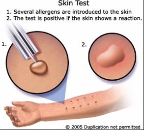 Asthma allergy clinic - Asthma allergy clinic