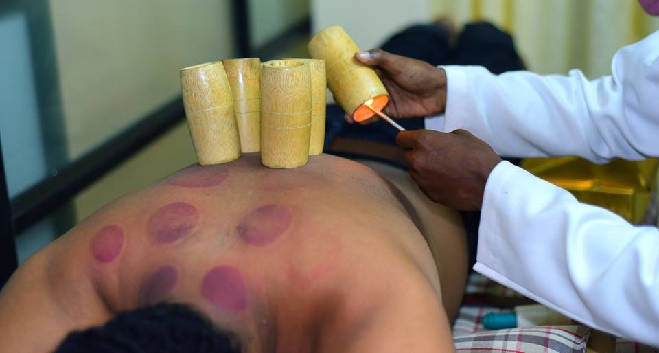 AURA الوخز بالإبر Hijama and Yoga Clinic, - AURA Acupuncture Hijama and Yoga Clinic,