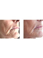 Aura Health & Beauty - Aura Health & Beauty