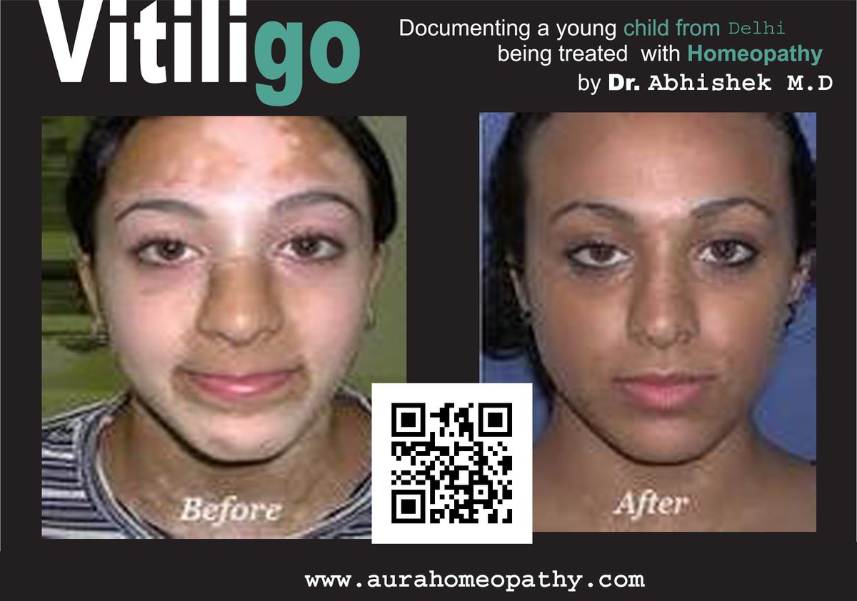 Aura Homeopathy Clinic & Research Centre India - Aura Homeopathy Clinic & Research Centre India