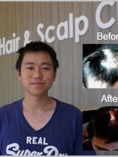 Australian Hair and Scalp Clinic (Aushair) - Australian Hair and Scalp Clinic (Aushair)