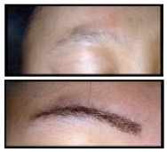 Australian Institute of Hair Restoration - Melbourne - Australian Institute of Hair Restoration - Melbourne