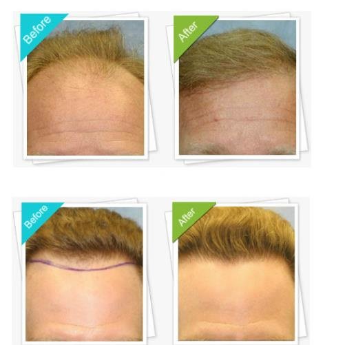 Australian Institute of Hair Restoration - Melbourne - Australian Institute of Hair Restoration - Melbourne