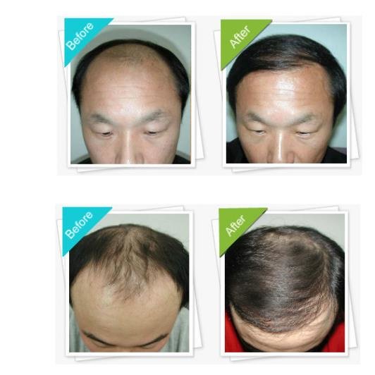 Australian Institute of Hair Restoration - Melbourne - Australian Institute of Hair Restoration - Melbourne