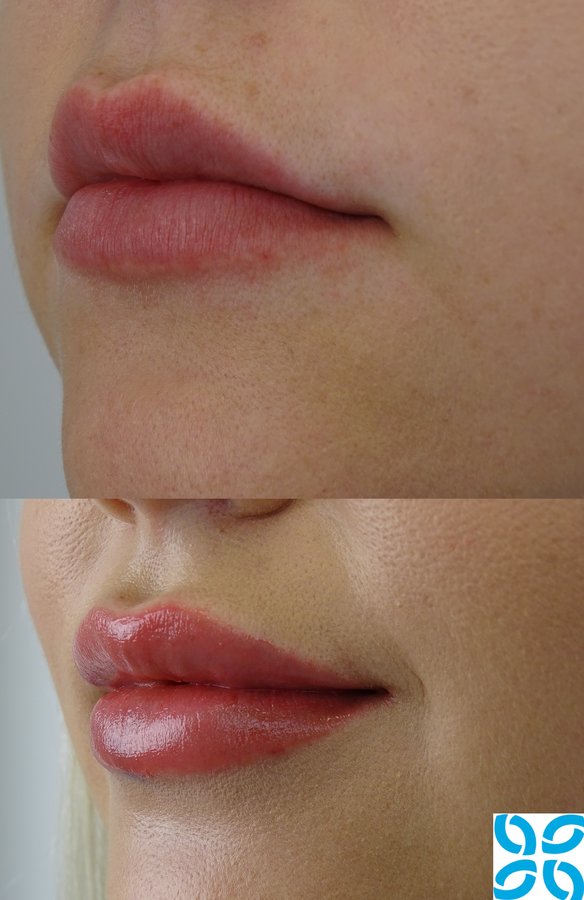 عيادات الجلد الأسترالية - Australian Skin Clinics