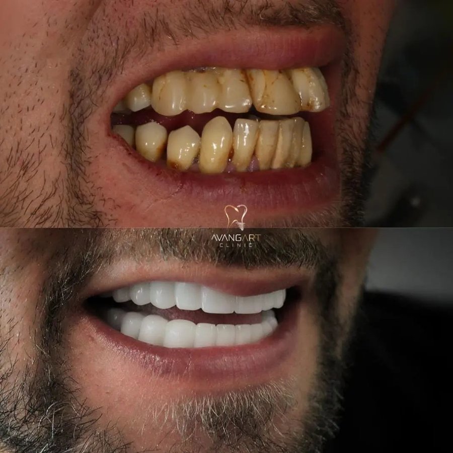 Avangart Clinic - Avangart Clinic