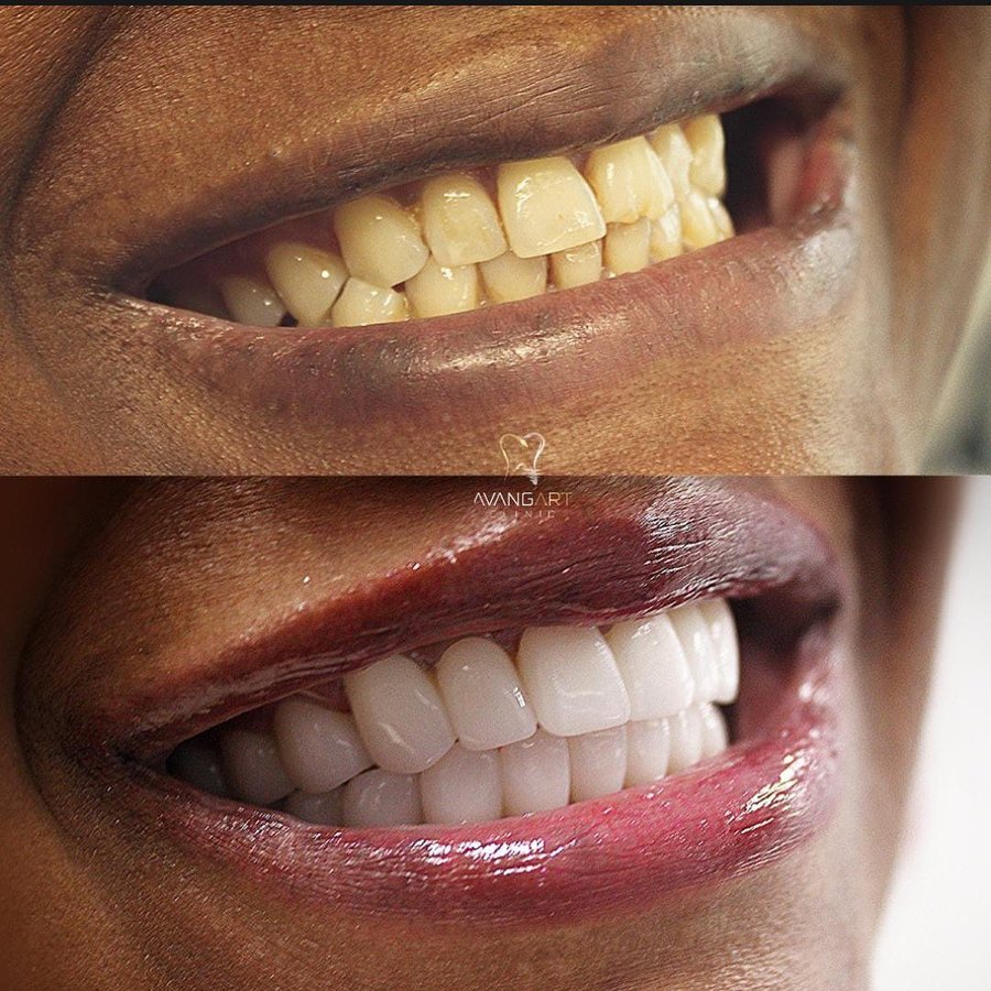 Avangart Clinic - Avangart Clinic