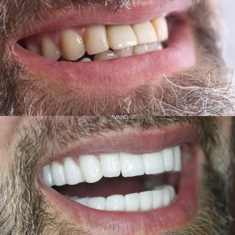 Avangart Clinic - Avangart Clinic