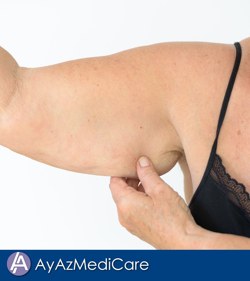 AyAz MediCare - AyAz MediCare