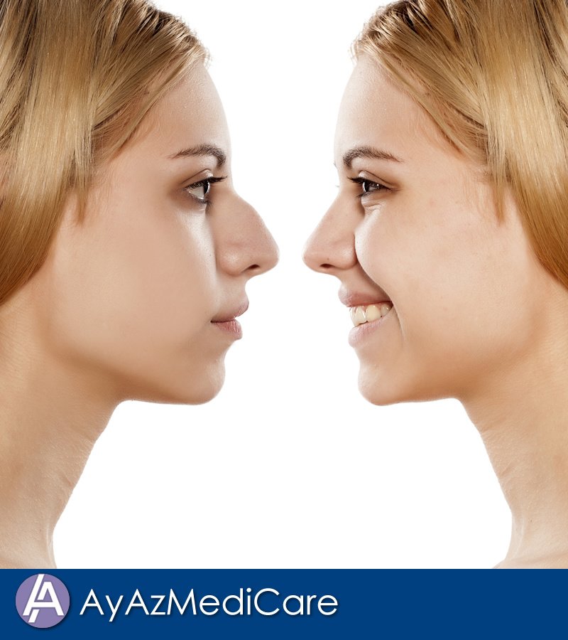 AyAz MediCare - AyAz MediCare