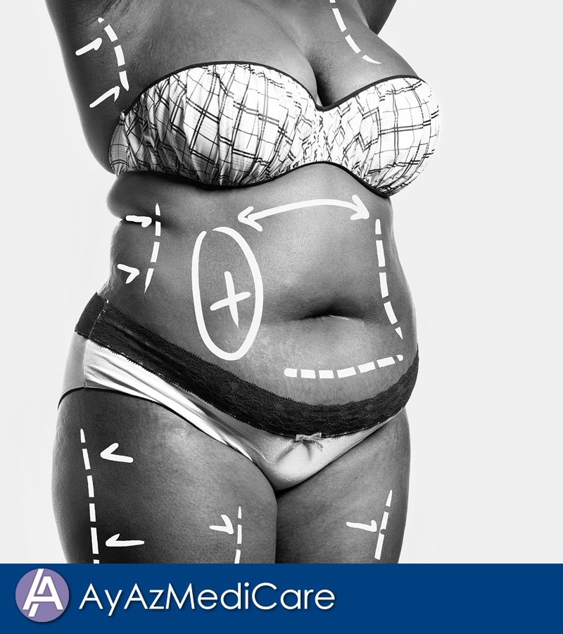 AyAz MediCare - AyAz MediCare