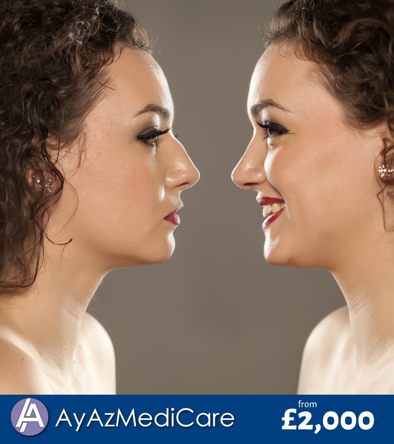 AyAz MediCare - AyAz MediCare