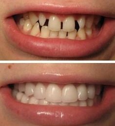 Ayoub Dental Clinic - Ayoub Dental Clinic