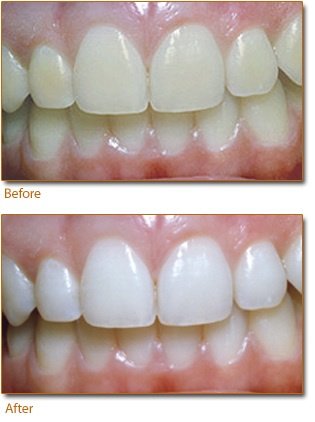 Ayoub Dental Clinic - Ayoub Dental Clinic