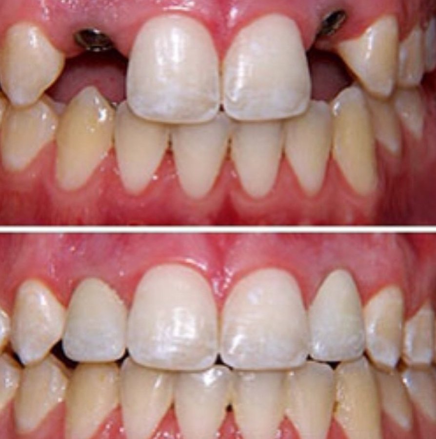 Ayoub Dental Clinic - Ayoub Dental Clinic