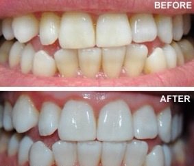 Ayoub Dental Clinic - Ayoub Dental Clinic