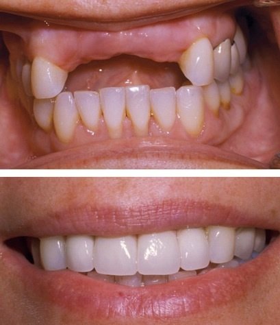 Ayoub Dental Clinic - Ayoub Dental Clinic