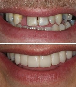 Ayoub Dental Clinic - Ayoub Dental Clinic