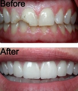 Ayoub Dental Clinic - Ayoub Dental Clinic