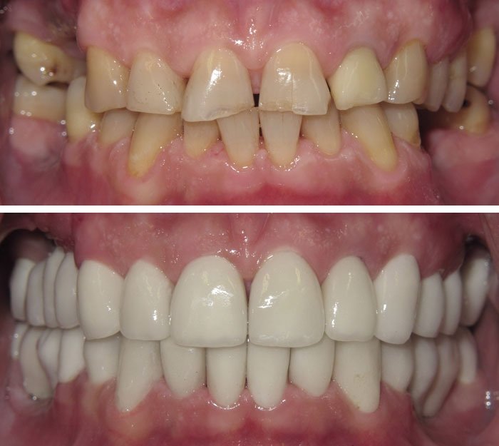 Ayoub Dental Clinic - Ayoub Dental Clinic