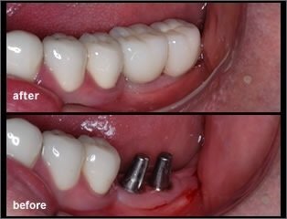 Ayoub Dental Clinic - Ayoub Dental Clinic