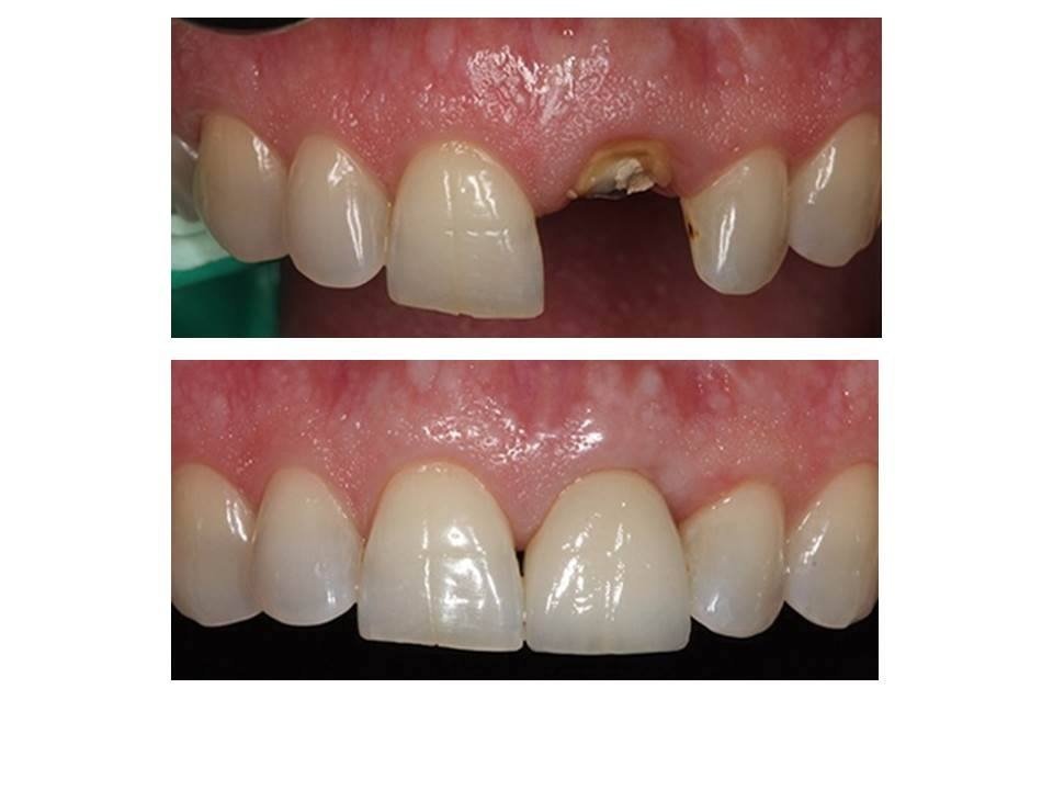 Ayoub Dental Clinic - Ayoub Dental Clinic