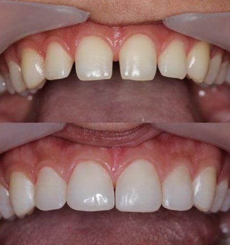 Ayoub Dental Clinic - Ayoub Dental Clinic