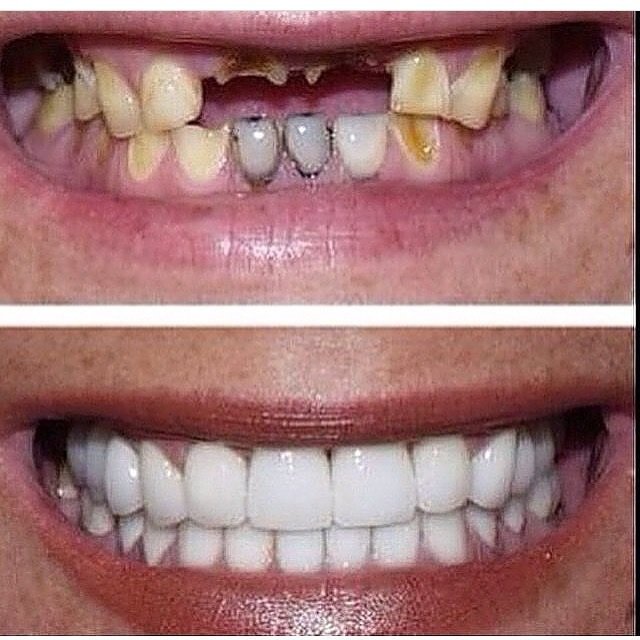 Ayoub Dental Clinic - Ayoub Dental Clinic