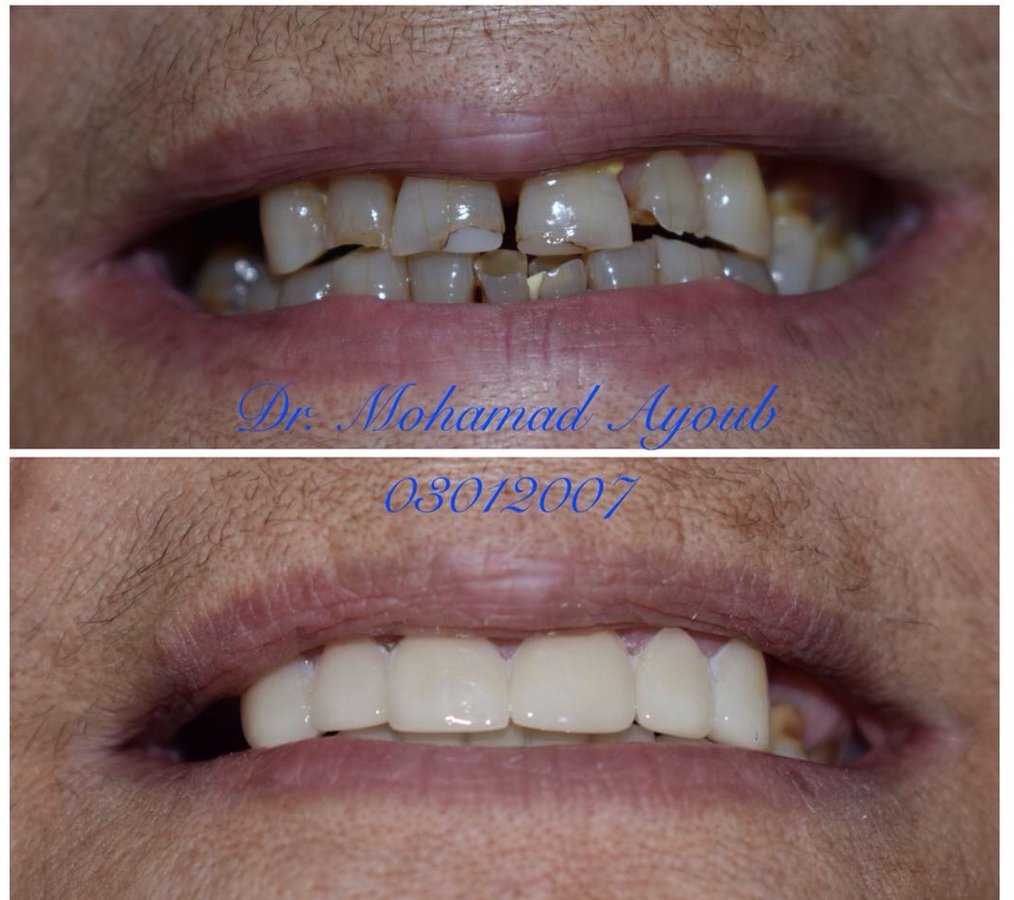 Ayoub Dental Clinic - Ayoub Dental Clinic