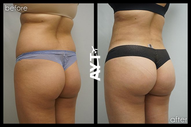 AYT CLINIC - AYT CLINIC