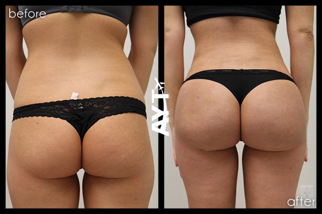 AYT CLINIC - AYT CLINIC