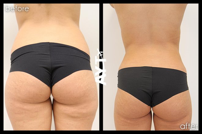 AYT CLINIC - AYT CLINIC