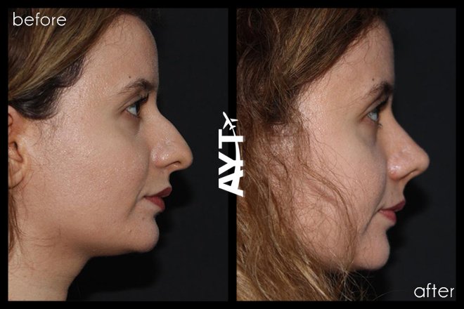 AYT CLINIC - AYT CLINIC