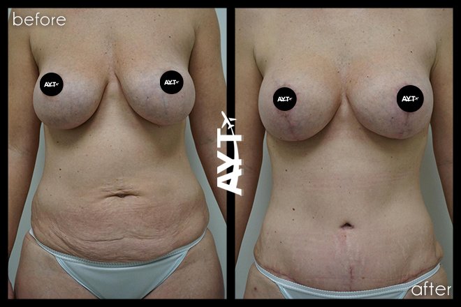 AYT CLINIC - AYT CLINIC