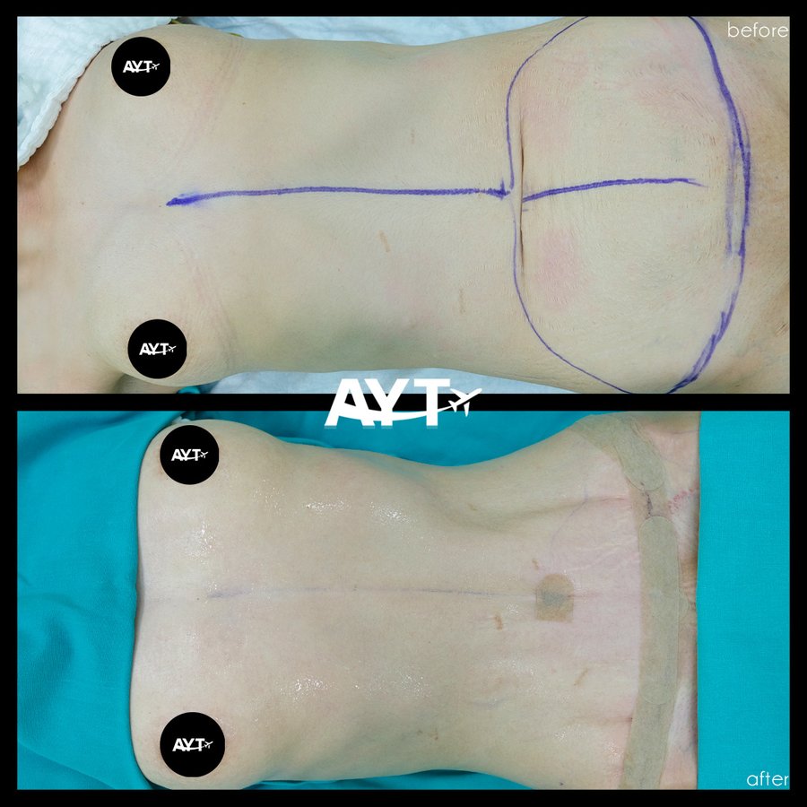 AYT CLINIC - AYT CLINIC