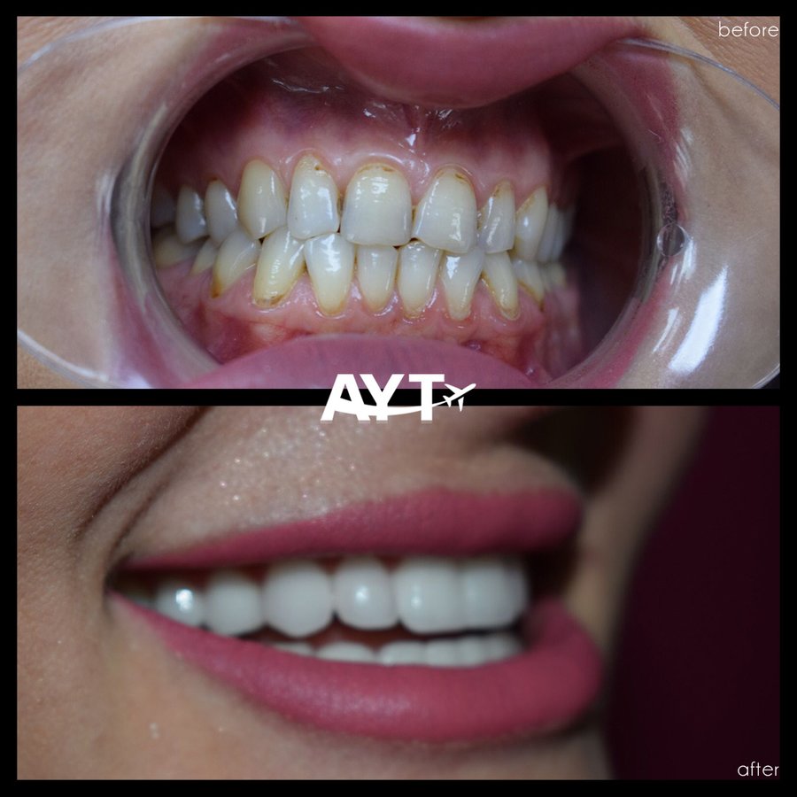 AYT CLINIC - AYT CLINIC