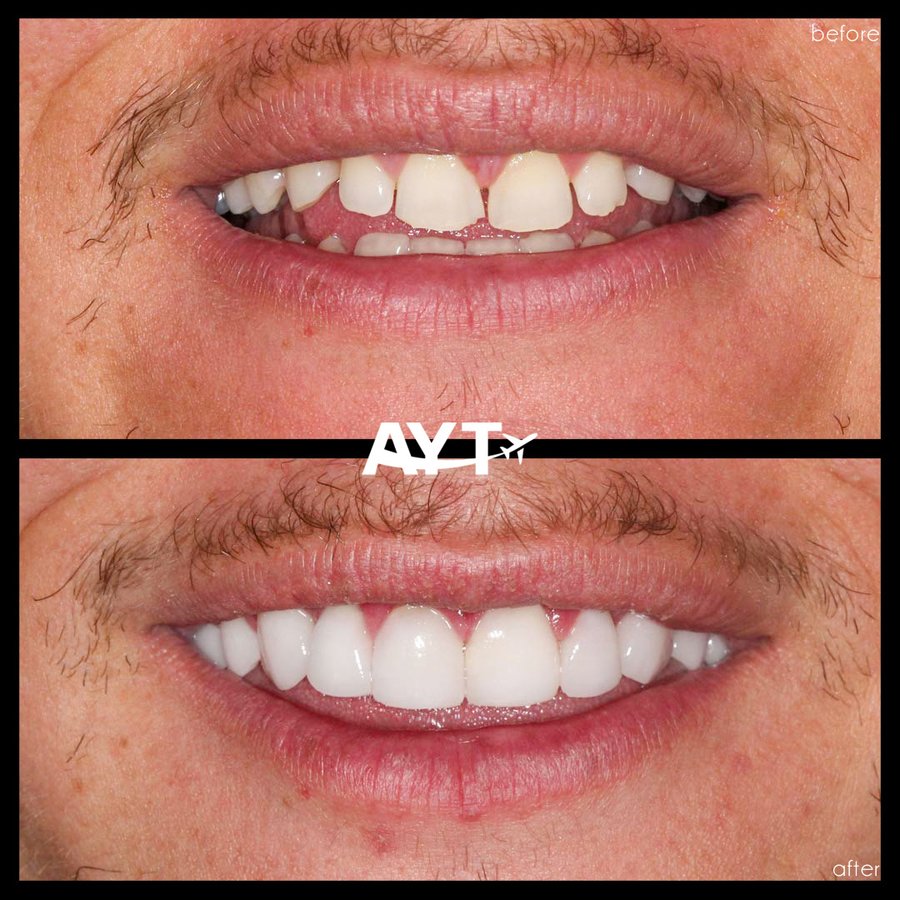 AYT CLINIC - AYT CLINIC