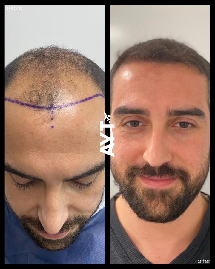 AYT CLINIC - AYT CLINIC