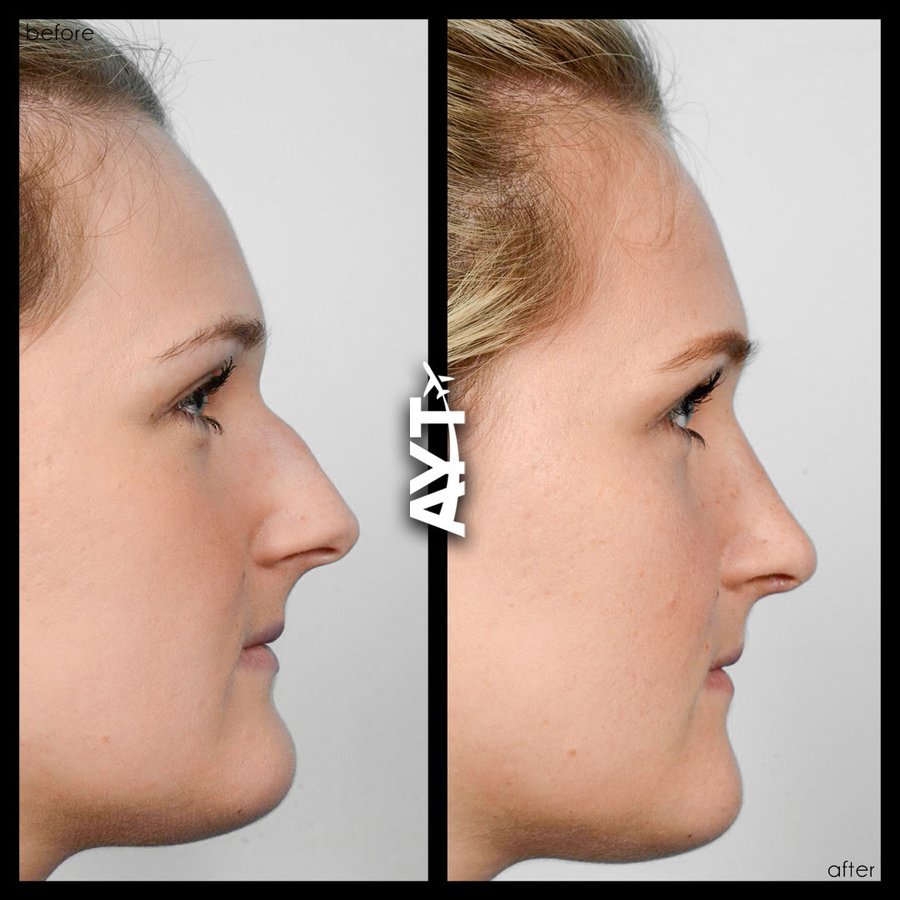 AYT CLINIC - AYT CLINIC