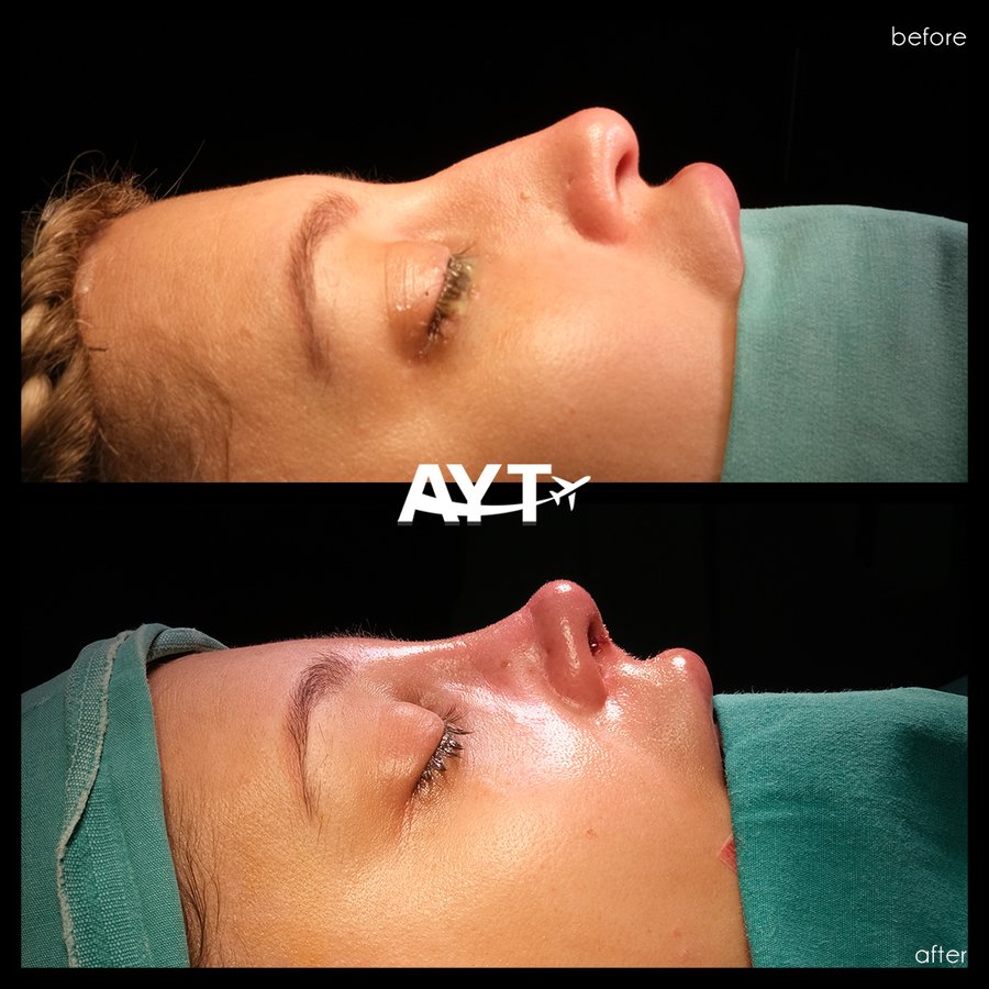 AYT CLINIC - AYT CLINIC