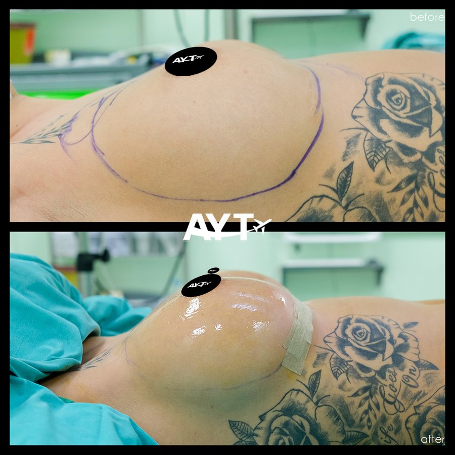 AYT CLINIC - AYT CLINIC