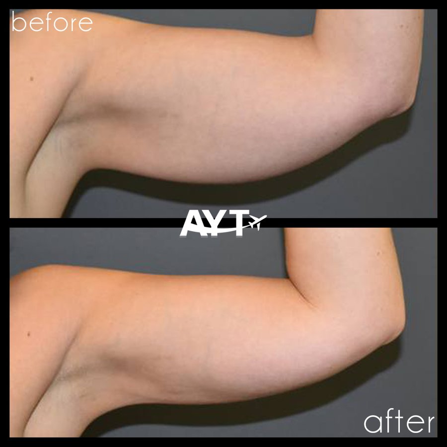 AYT CLINIC - AYT CLINIC