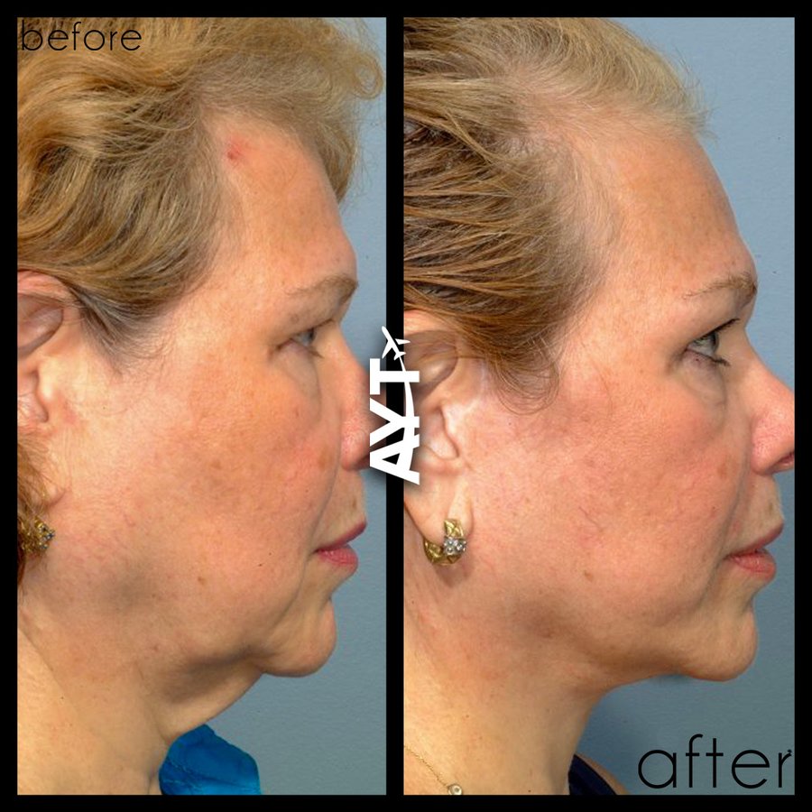 AYT CLINIC - AYT CLINIC