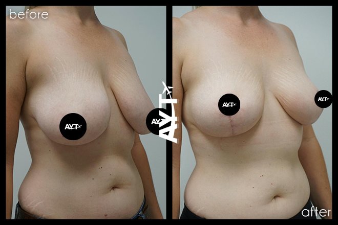 AYT CLINIC - AYT CLINIC