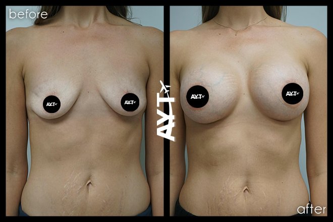 AYT CLINIC - AYT CLINIC