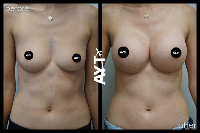 AYT CLINIC - AYT CLINIC