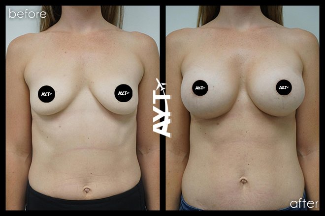 AYT CLINIC - AYT CLINIC