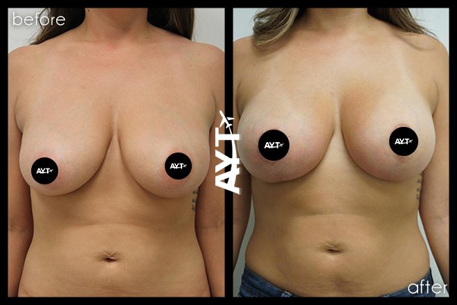 AYT CLINIC - AYT CLINIC