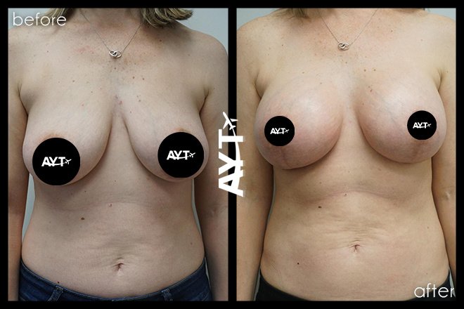 AYT CLINIC - AYT CLINIC